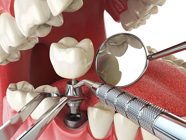 Best Tooth Pain Emergency Relief  in Russellton, PA